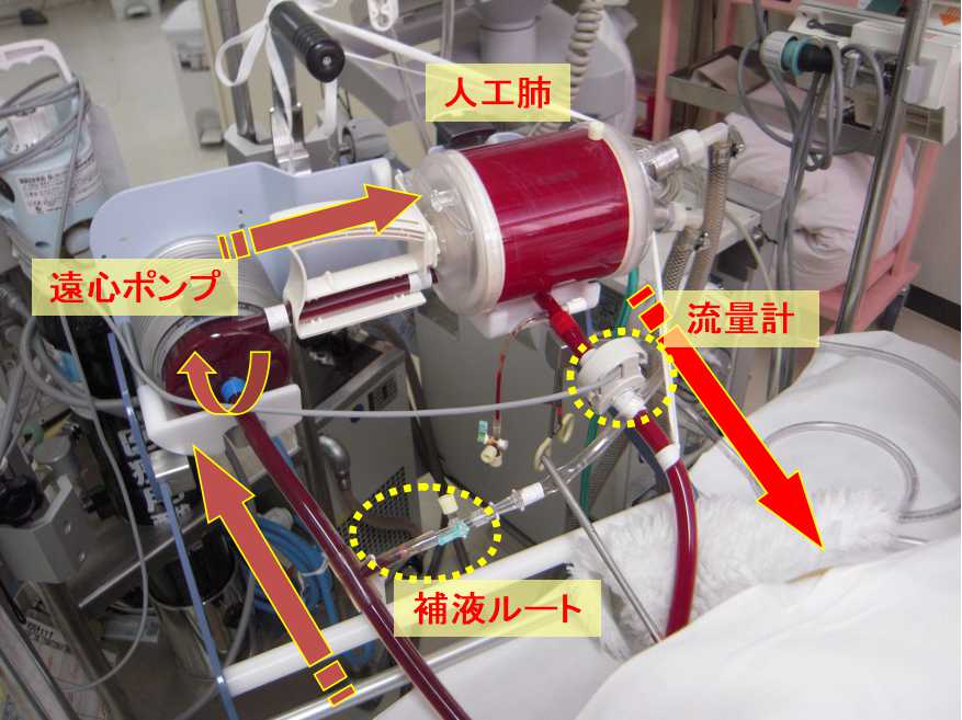 人工 呼吸 器 仕組み